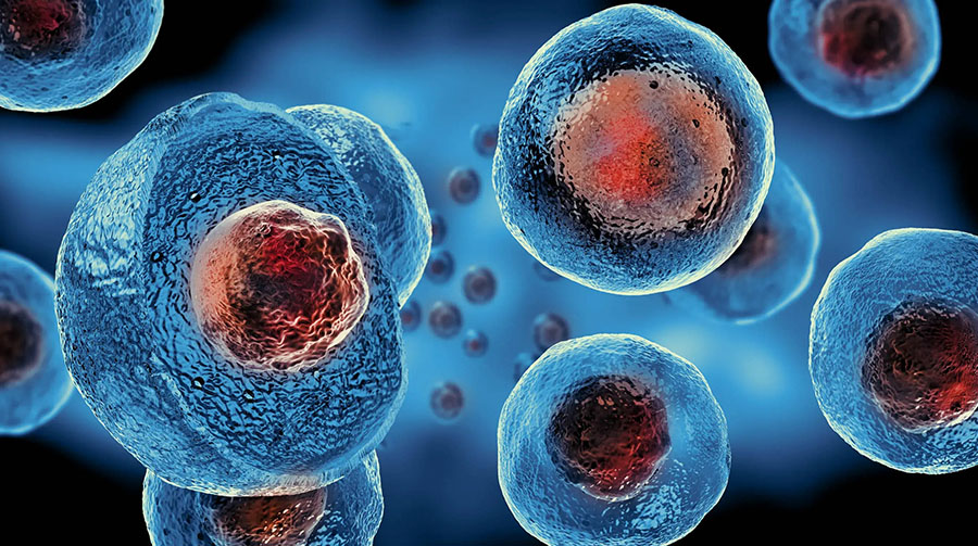 Стволовые клетки способны предотвратить пролапс органов таза