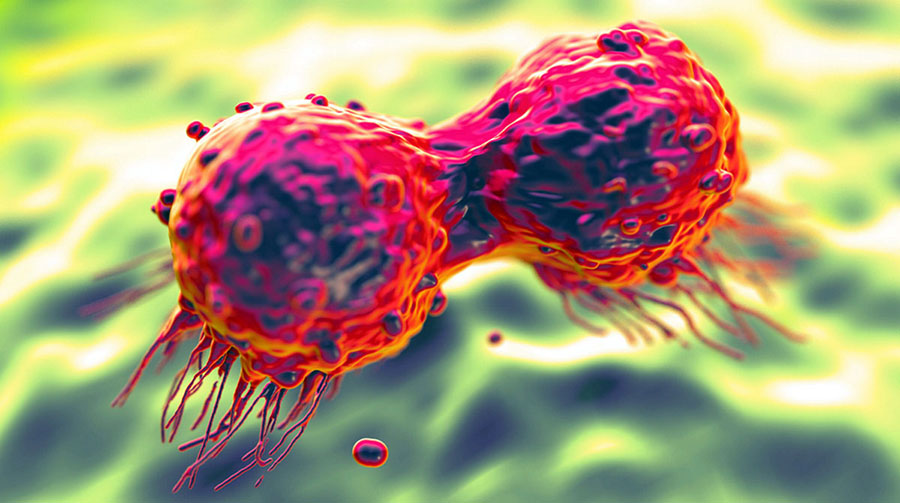 Молекулярный тест поможет отбирать больных раком почки для иммунотерапии